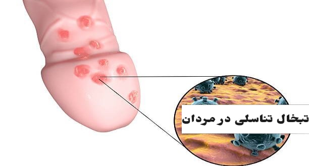 شکل ظاهری تبخال تناسلی در مردان / فرق زگیل و تبخال تناسلی در مردان