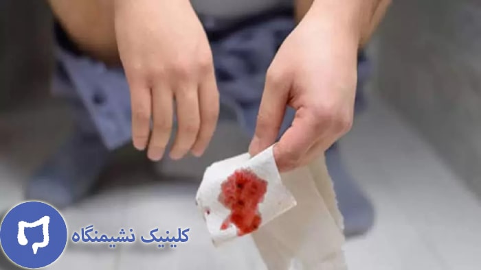 عکس هموروئید خونی