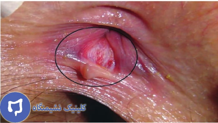 عکس فیشر مقعد