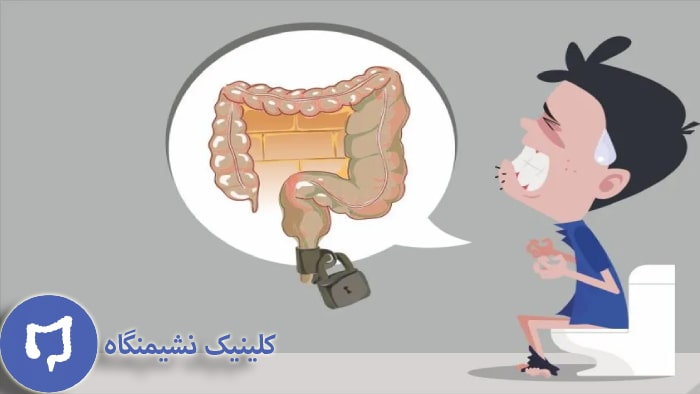 عکس فرد مبتلا شده به یبوست بیش از 5 روز