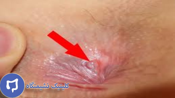 عکس فیشر مقعد