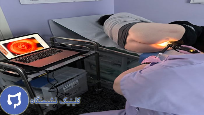 عکس جراحی فیشر با لیزر