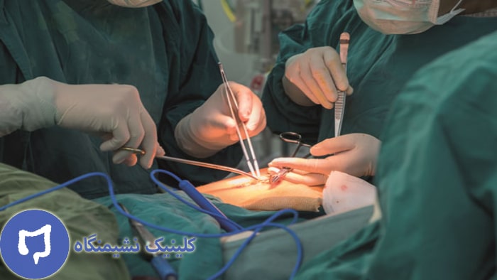 عکس درمان فیشر با لیزر