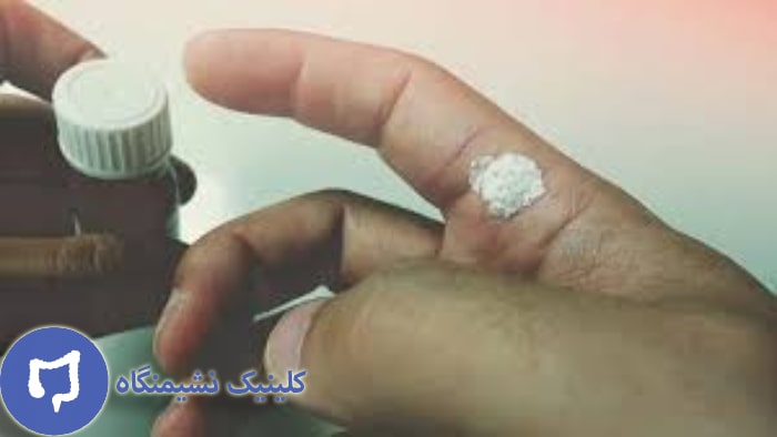 عکس درمان خانگی زگیل دست