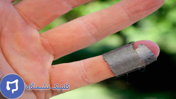 عکس چسب زگیل