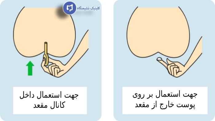 عکس طریقه مصرف پماد انتی هموروئید مقعدی