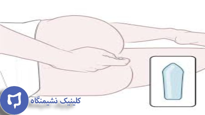 عکس نحوه استفاده از شیاف هموروئید