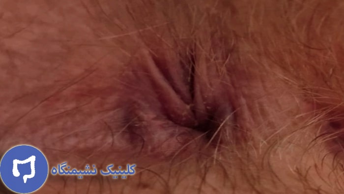 شقاق چیست با عکس