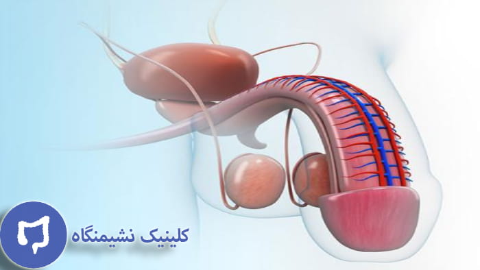 عکس الت