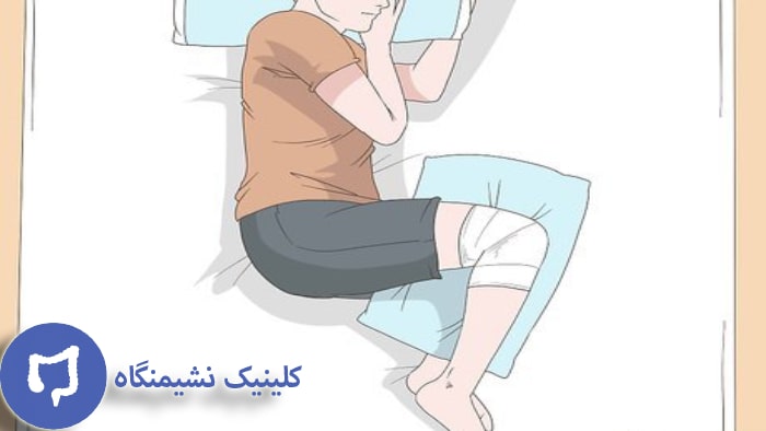 عکس نحوه خوابیدن بعد از عمل کیست مویی
