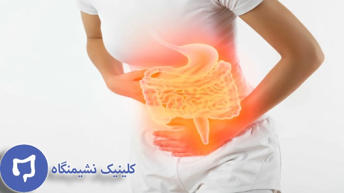 عکس علائم سندروم روده تحریک پذیر